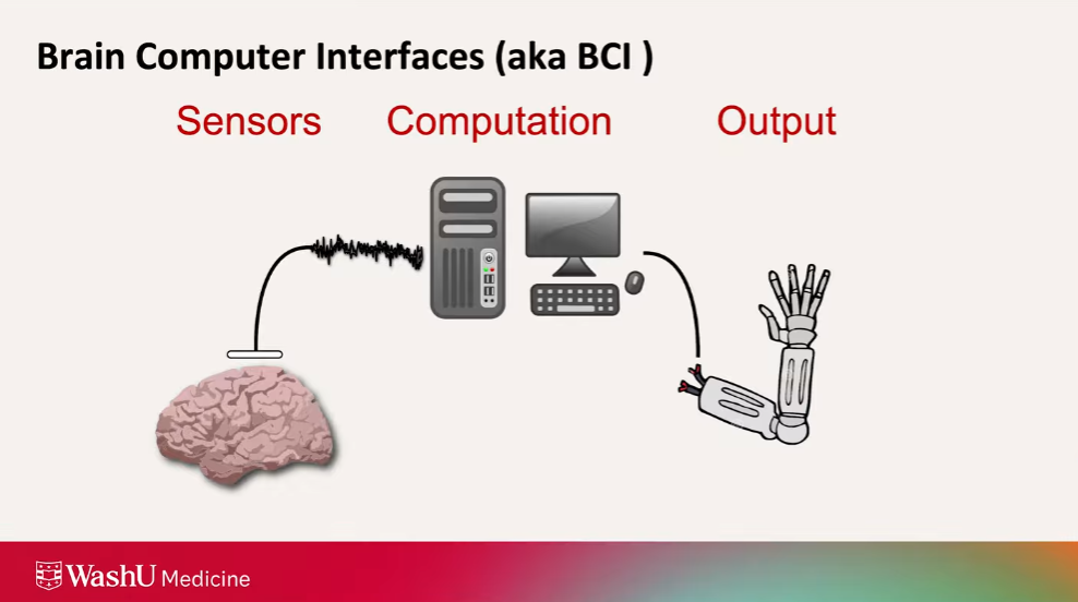 Результаты клинических испытаний BCI-REHAB (Neurolutions IpsiHand)
